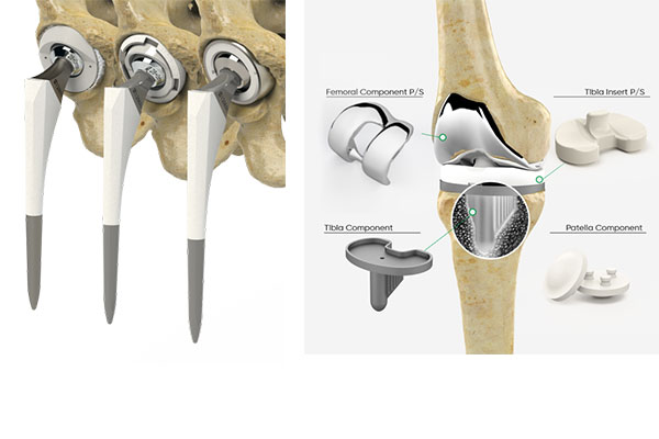 Ameliyat Malzemeleri - Protezler